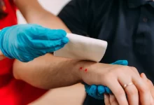 První pomoc při uštknutí hadem je klíčová.